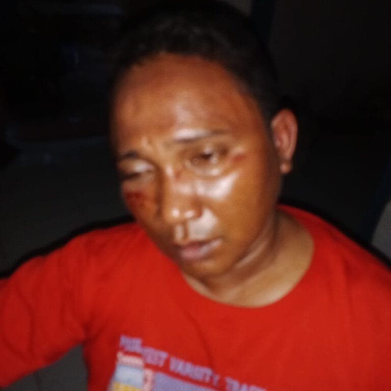TELAH TERJADI PENGROYOKAN TERHADAP SAUDARA ALOSIUS LUTURMAS OLEH WARGA MASYARAKAT DESA WABAR KECAMATAN WERLABOBAR.