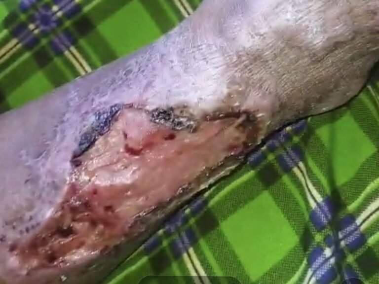 Menagih Hati Nurani di Balik Derita Warga Cidamar, Antara Jerit Sakit dan Dugaan Pungli yang Menjerat​