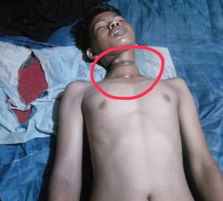 Remaja Ditemukan Tewas Gantung Diri di Pasar Pagi Betung Banyuasin